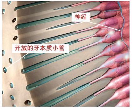 流体动力学说理论认为,牙本质小管被牙本质细胞突起及牙本质液所充盈