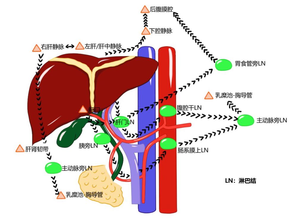 3 张手绘图,教你读懂肝脏淋巴回流