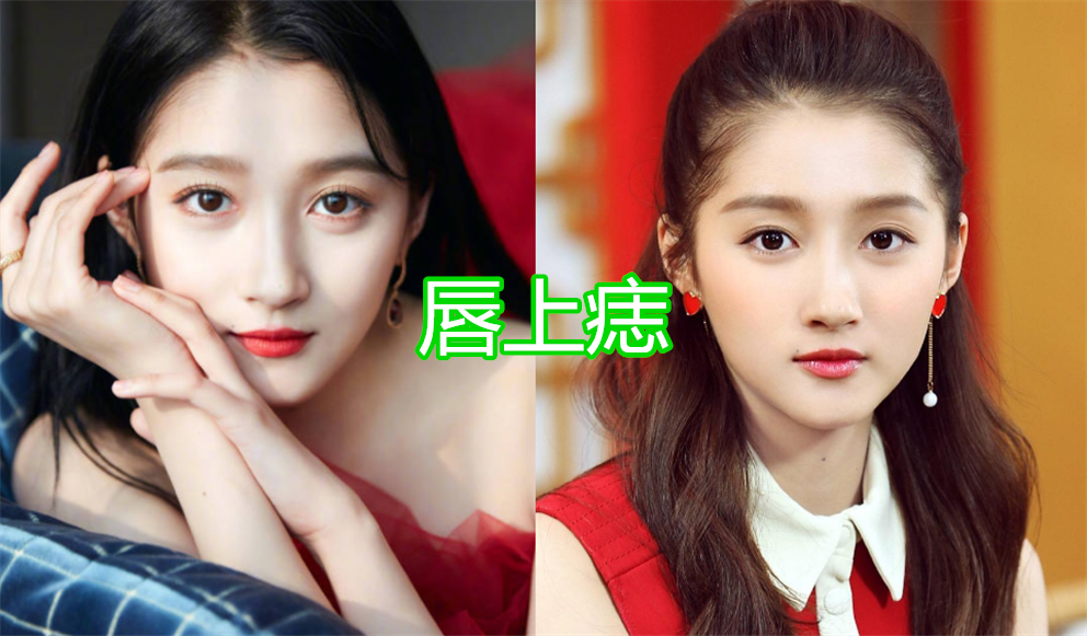 有种"优秀"叫女星脸上的痣,关晓彤唇上痣还好,看到鞠婧祎:心动了!