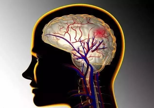 头部出现2个信号,你的脑血管已严重堵塞,3招快速清通