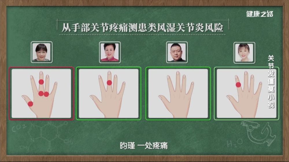 类风湿关节炎常表现为手部关节有压痛感,疼痛位置处于近端指间关节,掌