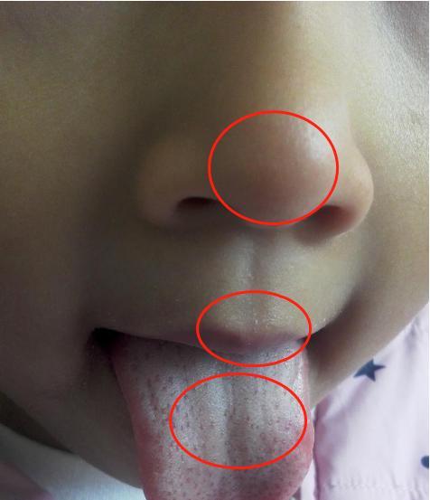 正常情况下,脾胃好的人鼻子周围颜色应是正常肤色或泛些红润,若发觉