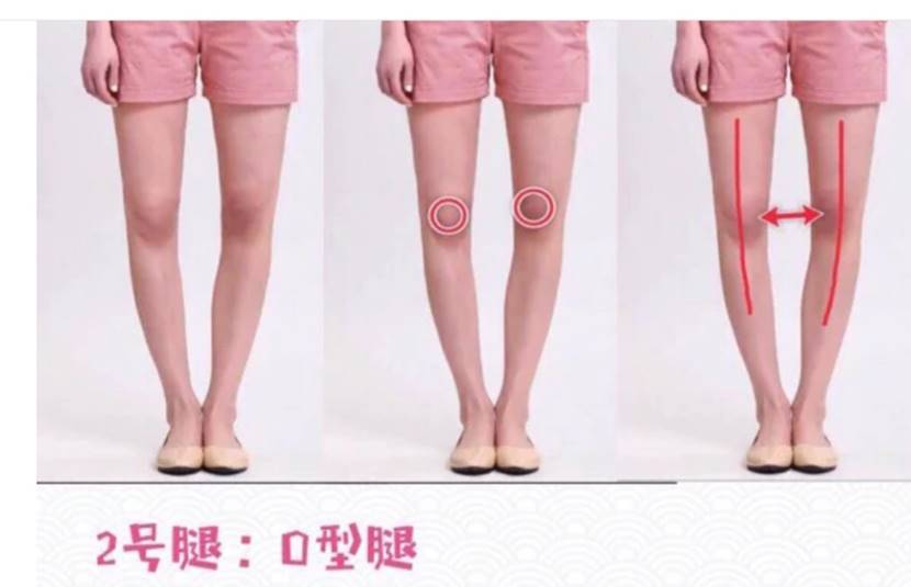 一,膝关节不能并拢,脚踝可以并拢 二,大腿和小腿弯曲方向一致,在一条