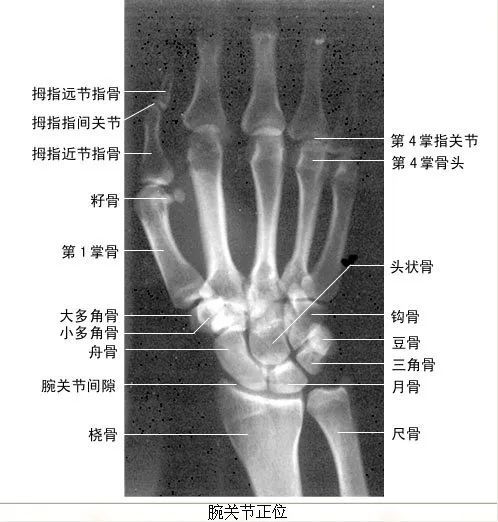 医师必会!x线片(收藏)