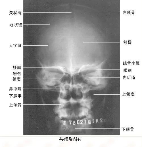 医师必会!x线片(收藏)