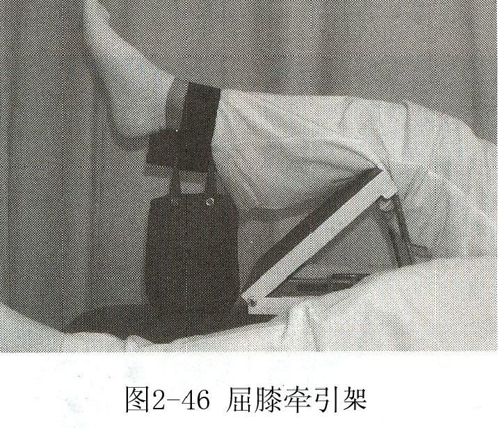 主动运动膝关节是人体中负重大,运动量大的关节,主要为屈戌关节,可