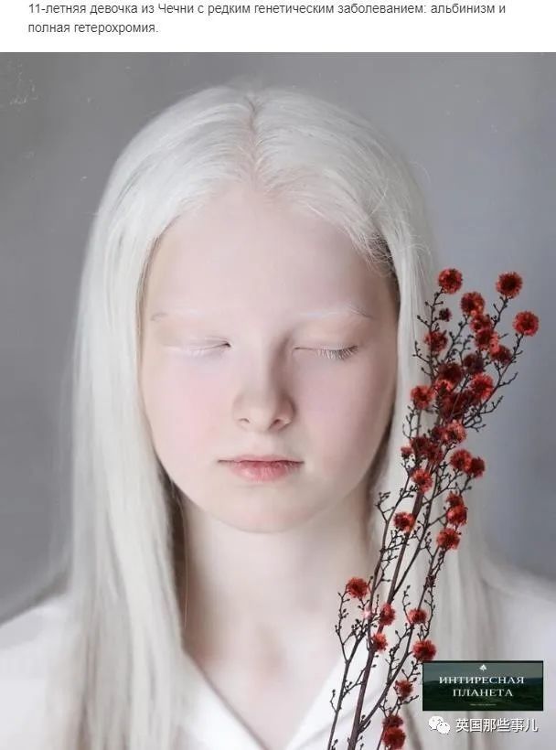一眼冰雪一眼森林这个白化病异色瞳的俄罗斯少女让网友震惊了