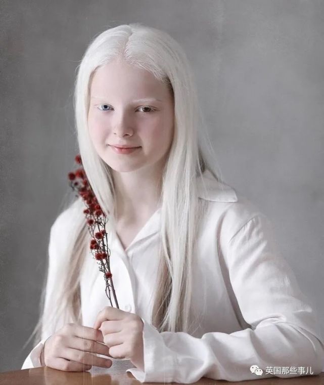 一眼冰雪,一眼森林…这个白化病 异色瞳的俄罗斯少女