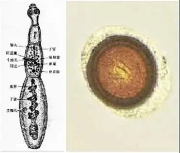 包虫不同时期形态,左为成虫,右为虫卵(图片来源:中山六院 微信公众号)