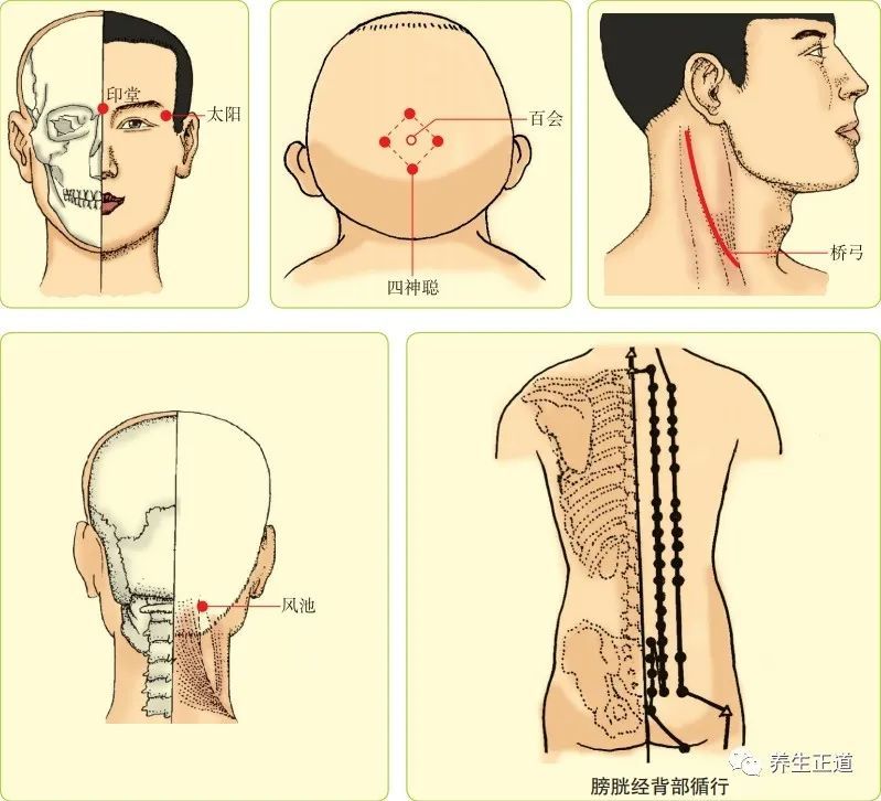 按摩手法 1. 取穴 选取印堂,太阳,百会,四神聪,左右桥弓,风池穴.