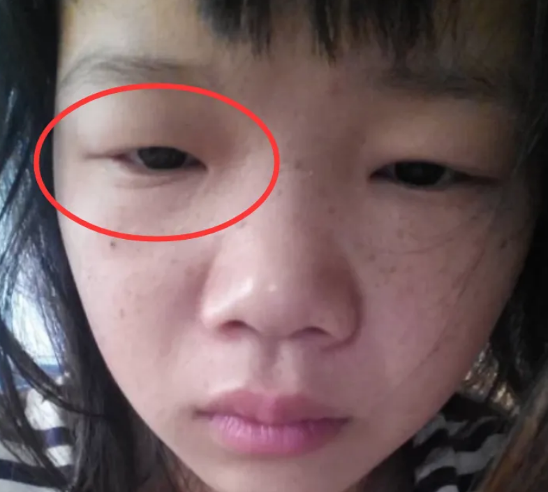 普通的单眼皮小眼睛是完全可以通过双眼皮贴化妆技术来变大双眼的