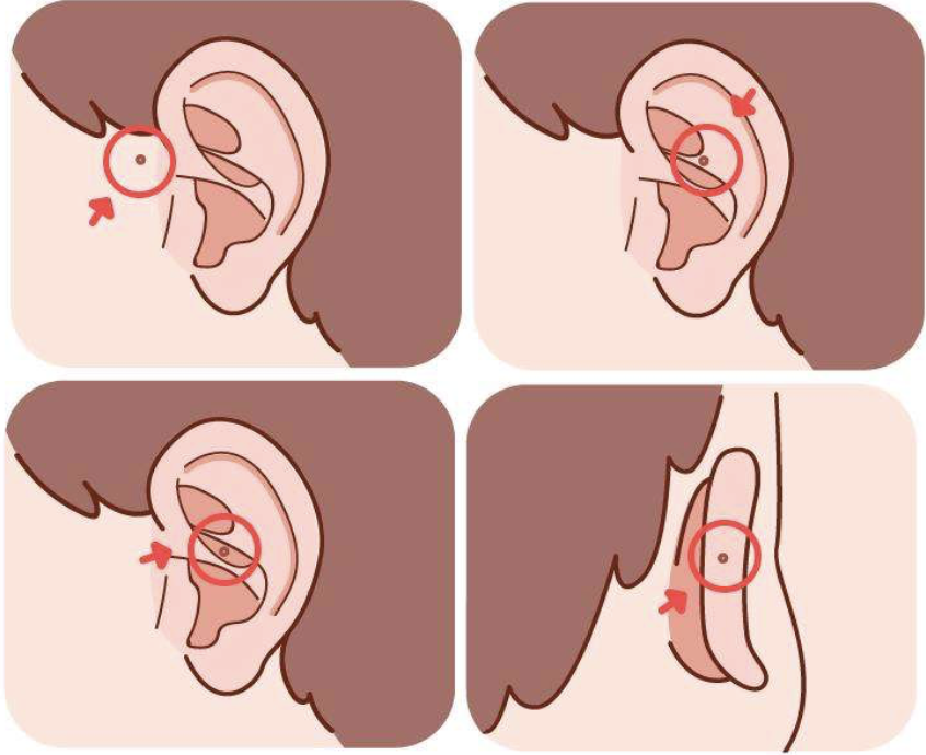 不到5%的人耳朵上有神秘小洞,里面藏着什么?