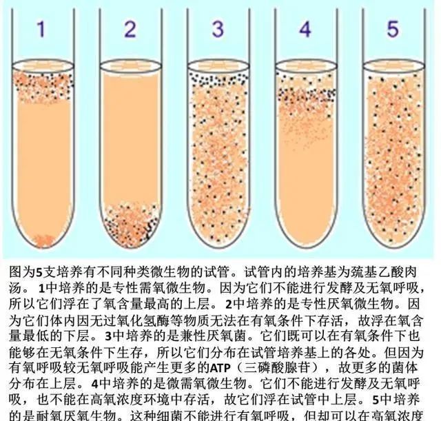 细菌的需氧/厌氧模式示意图,来源:умовский А.Н.