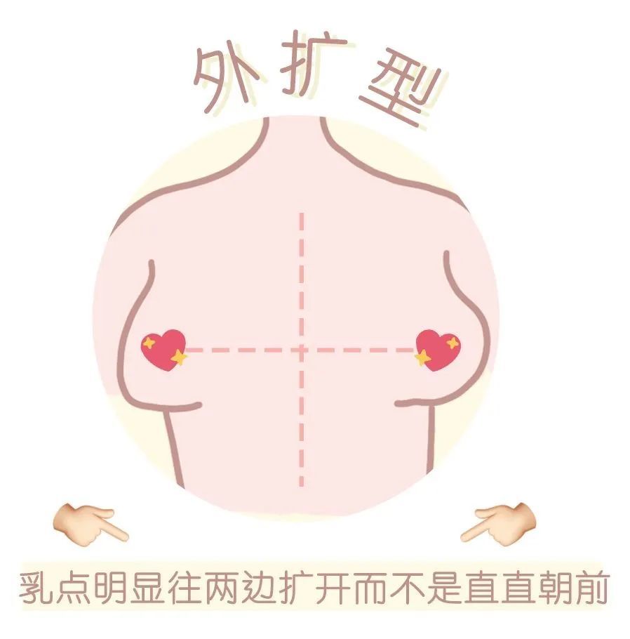 乳底保持着圆弧的样子 那这种其实 不是真正的「外扩」 只是你的胸长