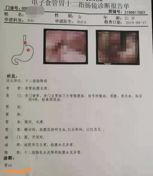 21岁女大学生确诊胃癌父亲一句哭诉道出悲剧的原因