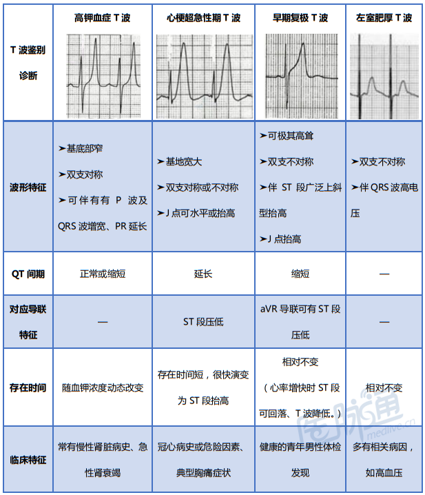 高钾血症心电图表现及鉴别诊断