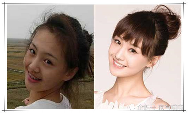 女星整牙前后对比:林心如整后笑容可人,唐嫣从"土妞"变女神