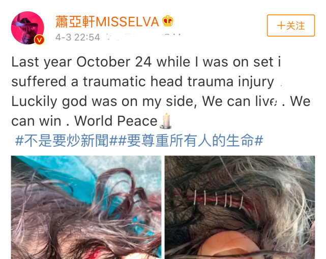 萧亚轩头部受伤照片曝光,路人看了都心疼