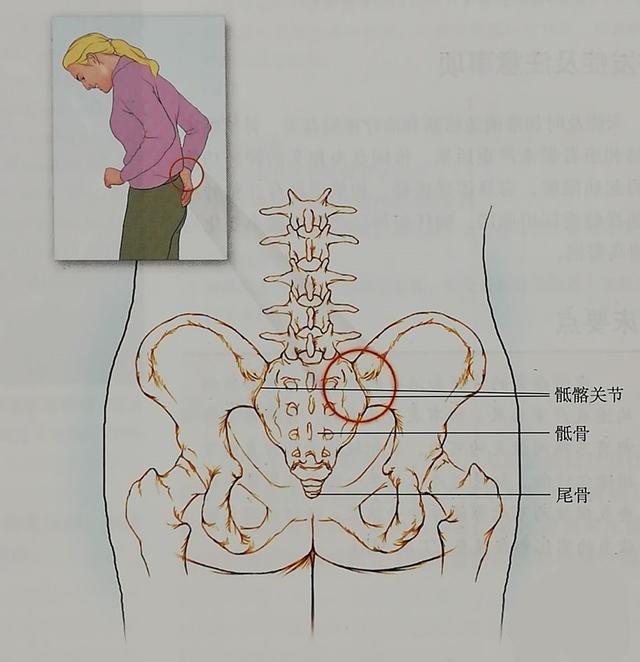 产后屁股疼,可能是骶髂关节紊乱导致,五个简单测试