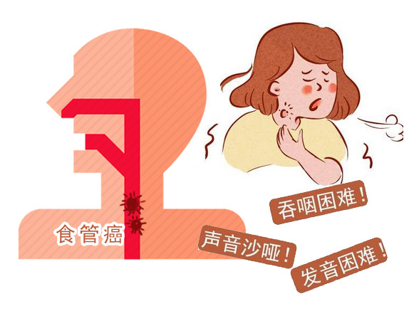 医生坦言:身体若有"三感一痛"的表现,或是早期食管癌