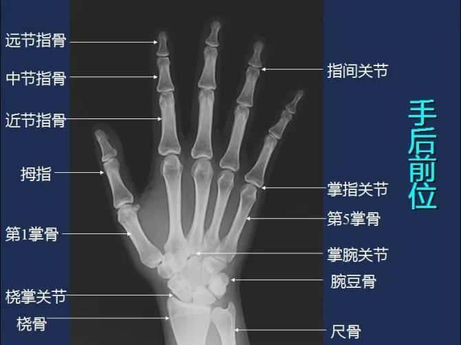 从头到脚高清x线图谱-看完功力大增!