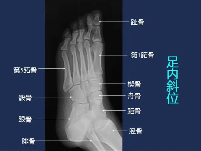 从头到脚高清x线图谱-看完功力大增!