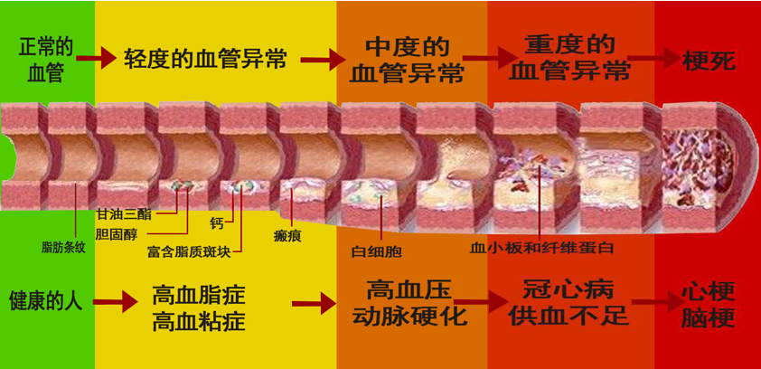 是什么把血管堵住了?