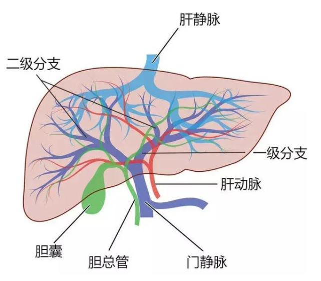 意外发现了肝癌,并伴有两个癌栓:肝门静脉瘤栓,下腔静脉瘤栓