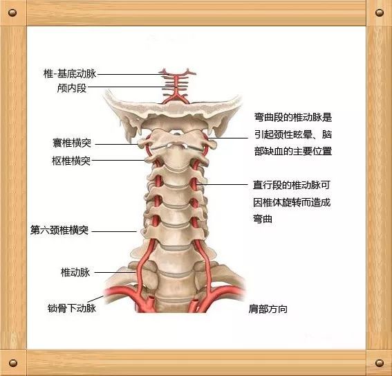 颈椎病引起的头晕,这主要是钩椎关节错位,椎体旋转;轻者导致椎曲紊乱