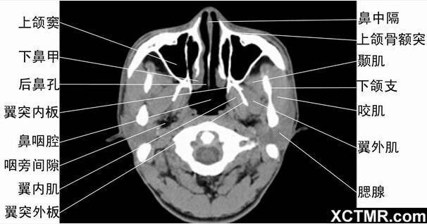 全面总结头颈五官ct解剖图