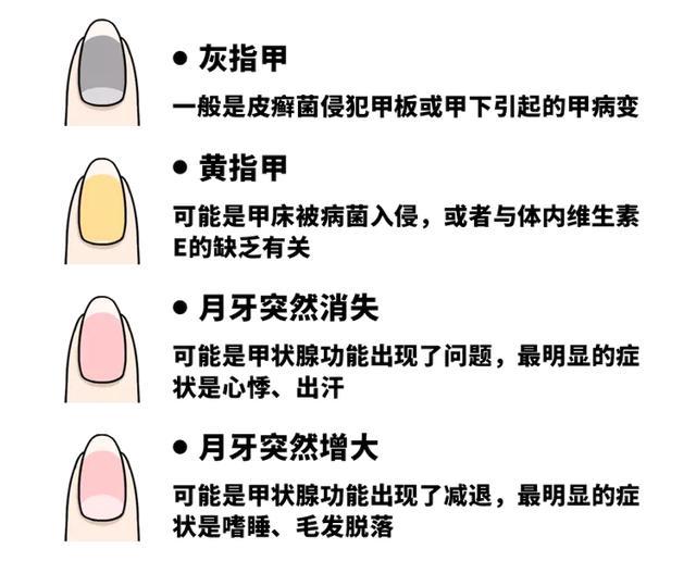指甲上没月牙,是不是身体差?透过指甲看健康,简单自测