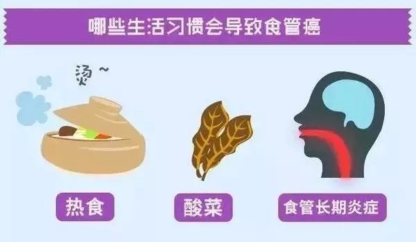 年仅29岁的他为何是晚期食管癌患者?罪魁祸首是酗酒熬夜,让癌症年轻化