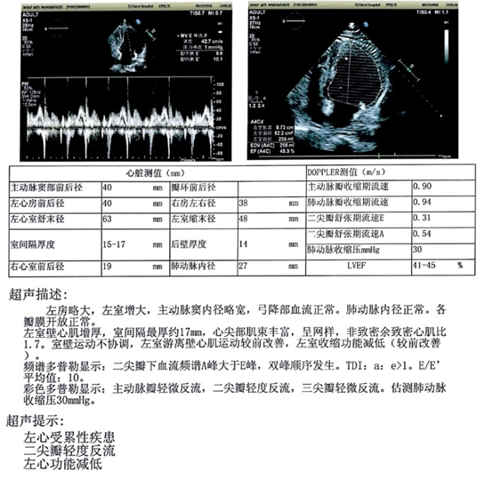 心肌致密化不全,这样的心衰应如何治疗?