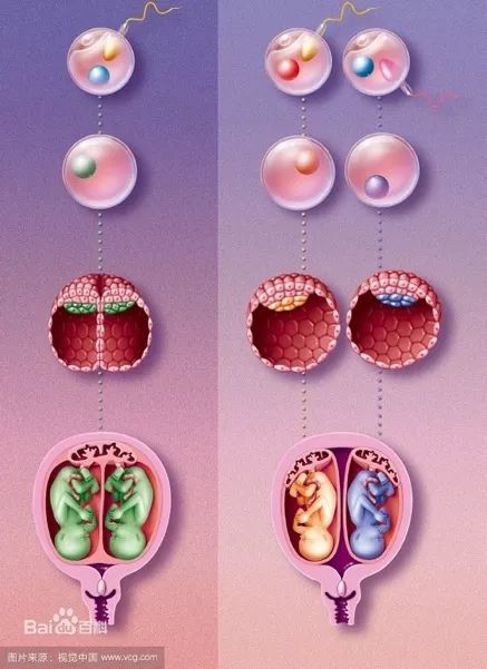 同卵双胞胎(左)和异卵双胞胎(右)的胚胎发育过程(图源:百度百科/视觉