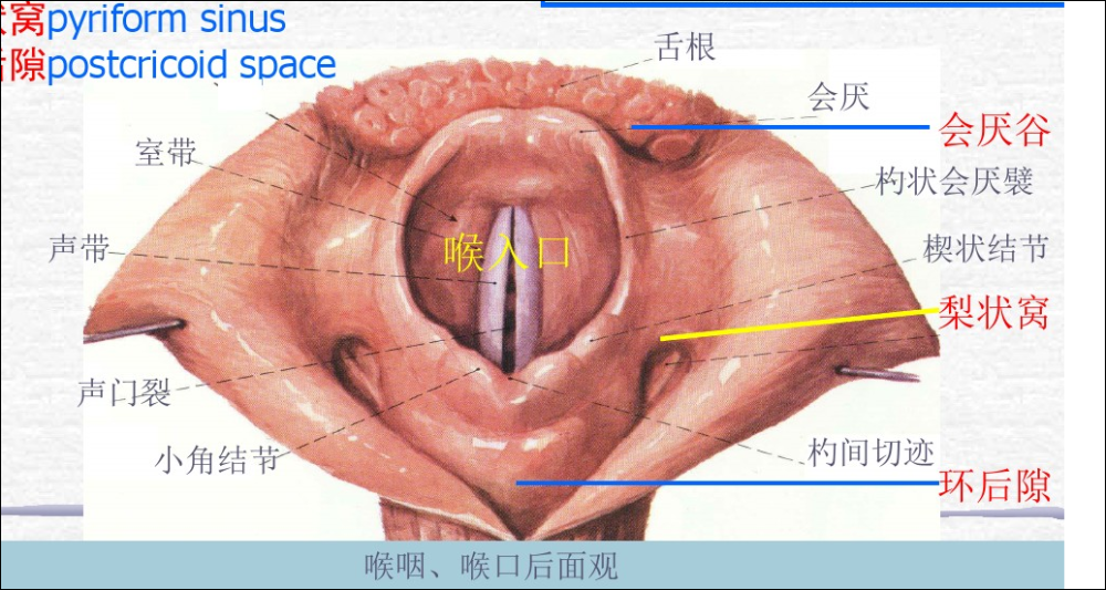 梨状隐窝,会厌谷解剖,正常吞咽示意图 (3)食团进入食道.