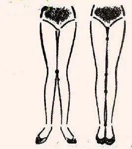 “X”型腿不好看？教你2步矫正，腿又细又直，好看