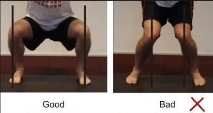 “X”型腿不好看？教你2步矫正，腿又细又直，好看