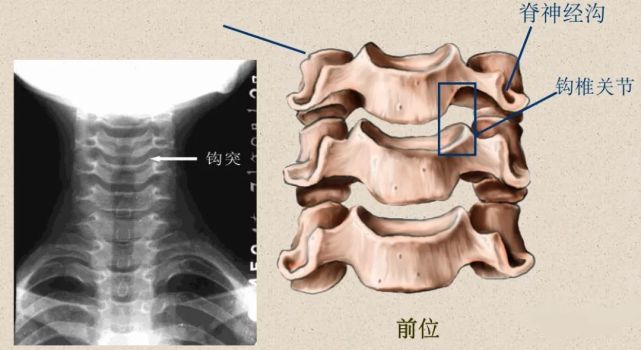 横突—横突孔,椎动脉,神经根沟 侧块,较大 关节面 棘突(分叉 b