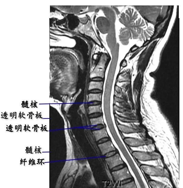 脊柱超详细图文解剖