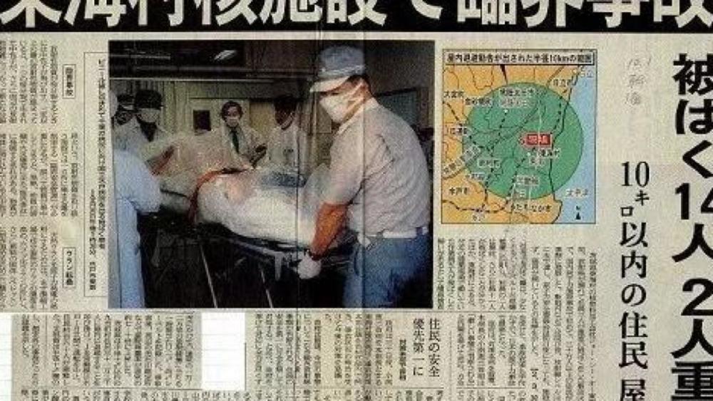 死法最惨烈的日本人:近距离遭受核辐射后,医生强行让其多活83天