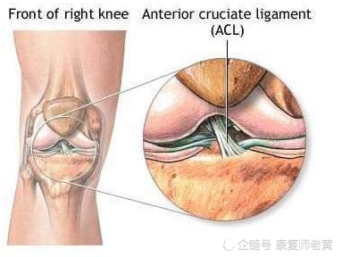 前交叉韧带位置