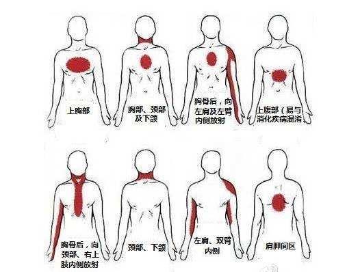 痛 心窩 部 腹痛とは～自然と治る腹痛、放っておくと怖い腹痛