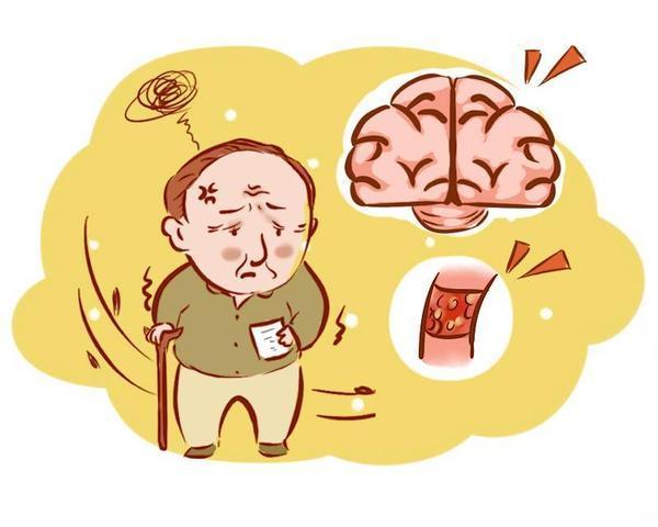 来临前有哪些前兆?预防脑血栓,需做