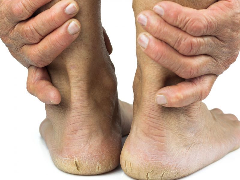 脚后跟总是产生疼痛感,可能和哪些疾病有关?