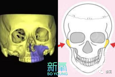 关键点就在于把凹的上颌部位提亮,凸的颧弓骨部位压暗.