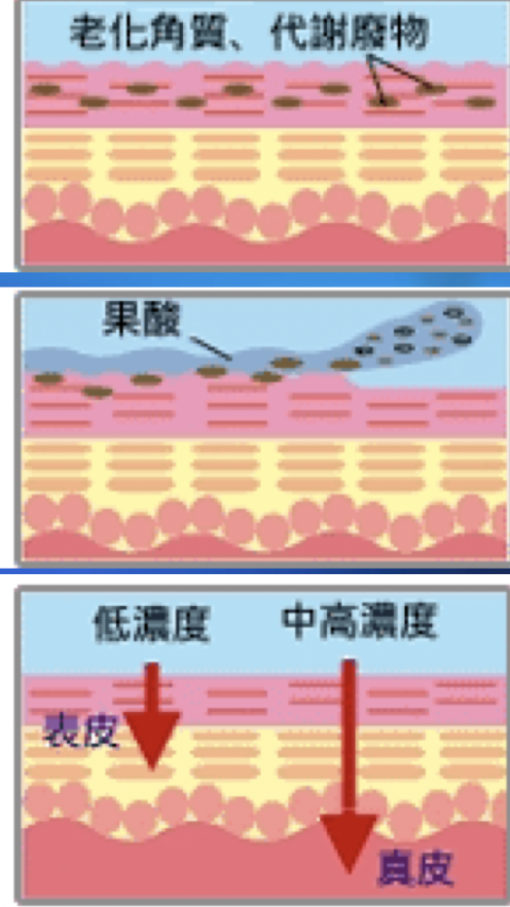 果酸我们到底怎么选