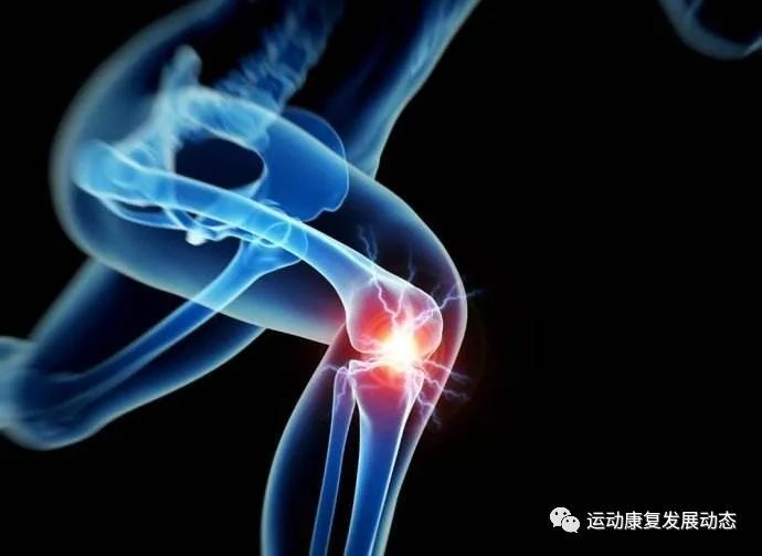 膝关节内侧副韧带损伤康复