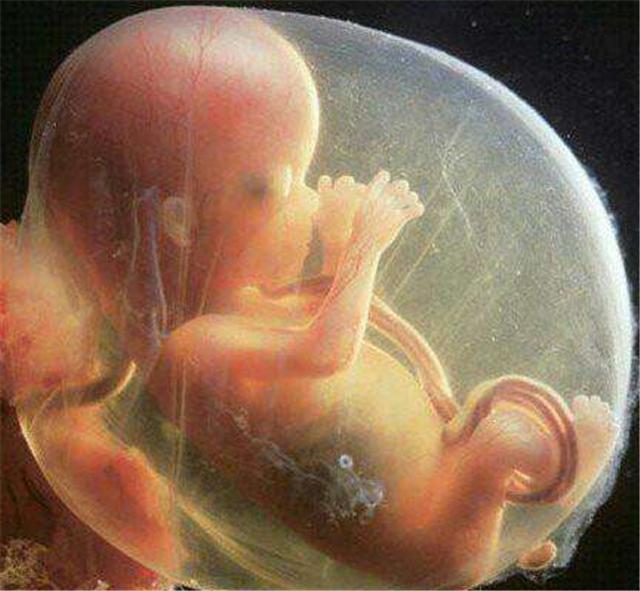 怀孕5个月的胎儿是什么样子的呢?孕妇怎样保养好身体