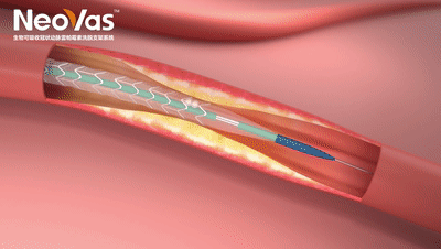 不止一种|可吸收支架|球囊|心脏|血管