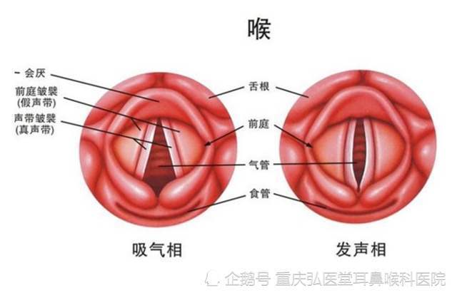 重庆弘医堂医院讲解:鼻咽炎的四个症状